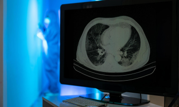 Anatomia Seccional por RM e TC – Tórax, Abdome e Pelve