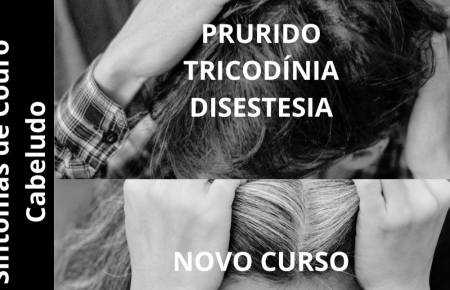 SINTOMAS DE COURO CABELUDO PRURIDO, TRICODÍNICA E DISESTESIA