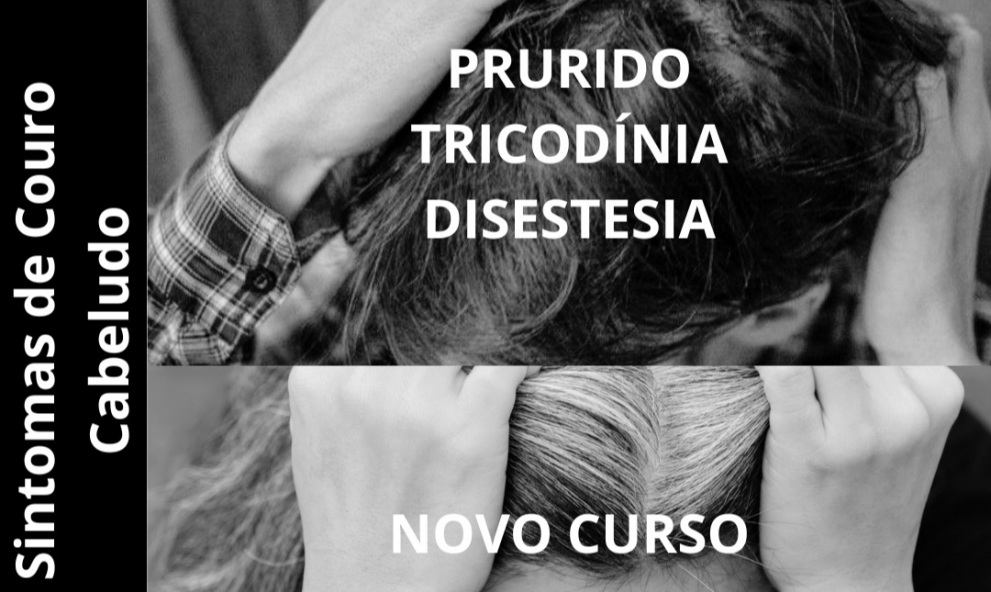 SINTOMAS DE COURO CABELUDO PRURIDO, TRICODÍNICA E DISESTESIA