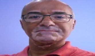 Pedro Fernando Alves De Almeida