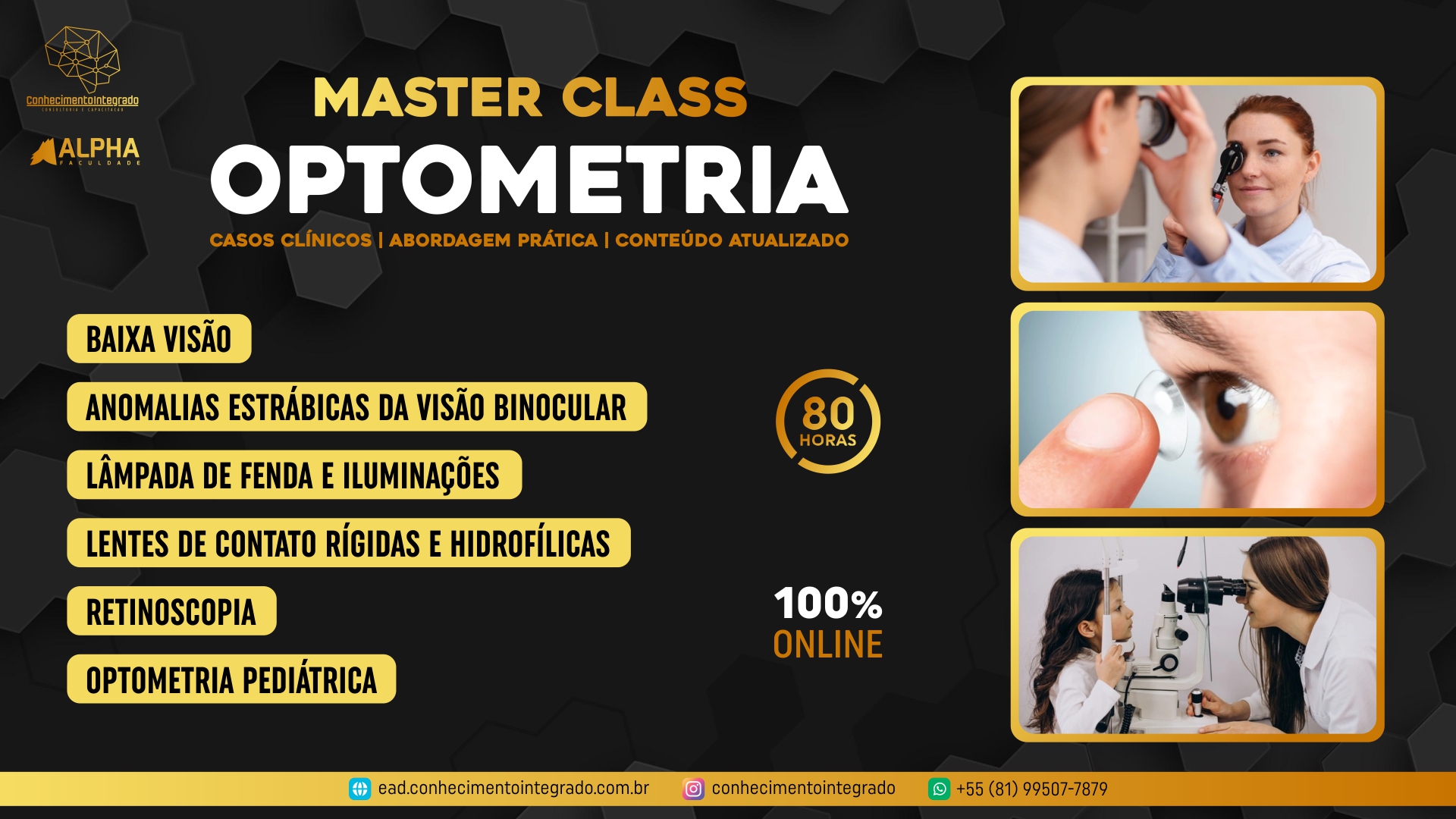 Master Class em Optometria - Conhecimento Integrado