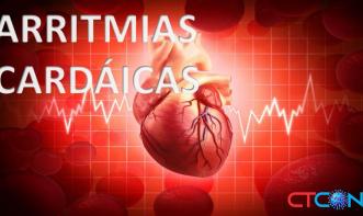 ARRITMIAS CARDÍACAS 