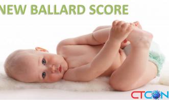 New Ballard Score - NBS