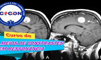MEIOS DE CONTRASTES EM RESSONÂNCIA MAGNÉTICA