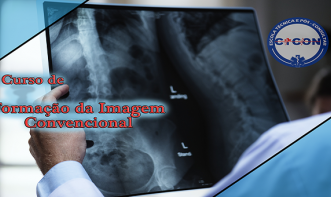FORMAÇÃO DA IMAGEM CONVENCIONAL