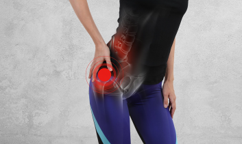 Estudo Radiológico do Impacto Femoroacetabular