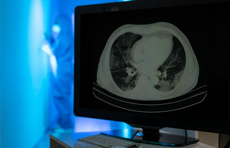 Anatomia Seccional por RM e TC – Tórax, Abdome e Pelve