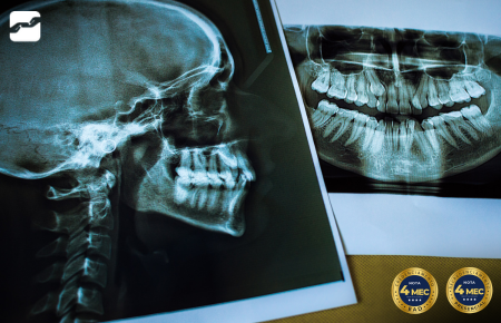 Radiologia Forense e Medicina Legal