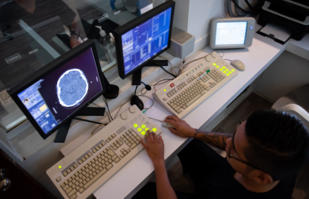 Angiotomografia e Tomografia Intervencionista