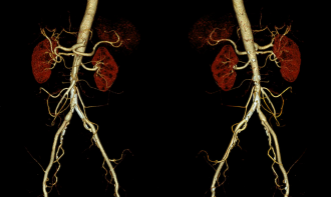 Protocolos de Angiotomografia, Como Realizar Seu Exame - Curso Avançado