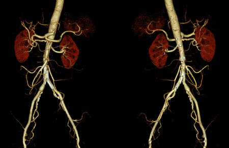 Protocolos de Angiotomografia, Como Realizar Seu Exame - Curso Avançado