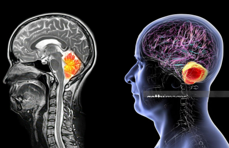 Anatomia Seccional por RM e TC - Neuroanatomia, Cabeça, Pescoço e Coluna Vertebral.