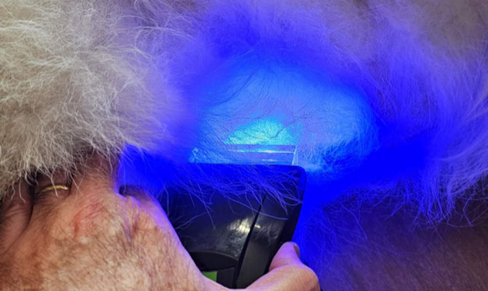 APLICAÇÃO DA LUZ AZUL EM CICATRIZAÇÃO DE FERIDAS