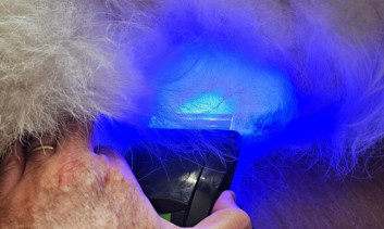 APLICAÇÃO DA LUZ AZUL EM CICATRIZAÇÃO DE FERIDAS