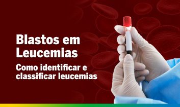 Blastos em Leucemias, como identificar e classificar leucemias