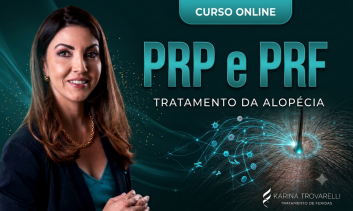 PRP e PRF no tratamendo da alopécia