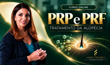 PRP e PRF no tratamento da alopécia