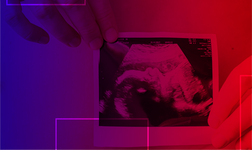 Curso de Ultrassonografia em Medicina Fetal 1° e 2° Trimestres e Doppler  Prof. Dr Sang C. Cha