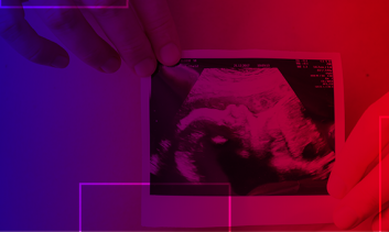 Curso de Ultrassonografia em Medicina Fetal 1° e 2° Trimestres e Doppler  Prof. Dr Sang C. Cha