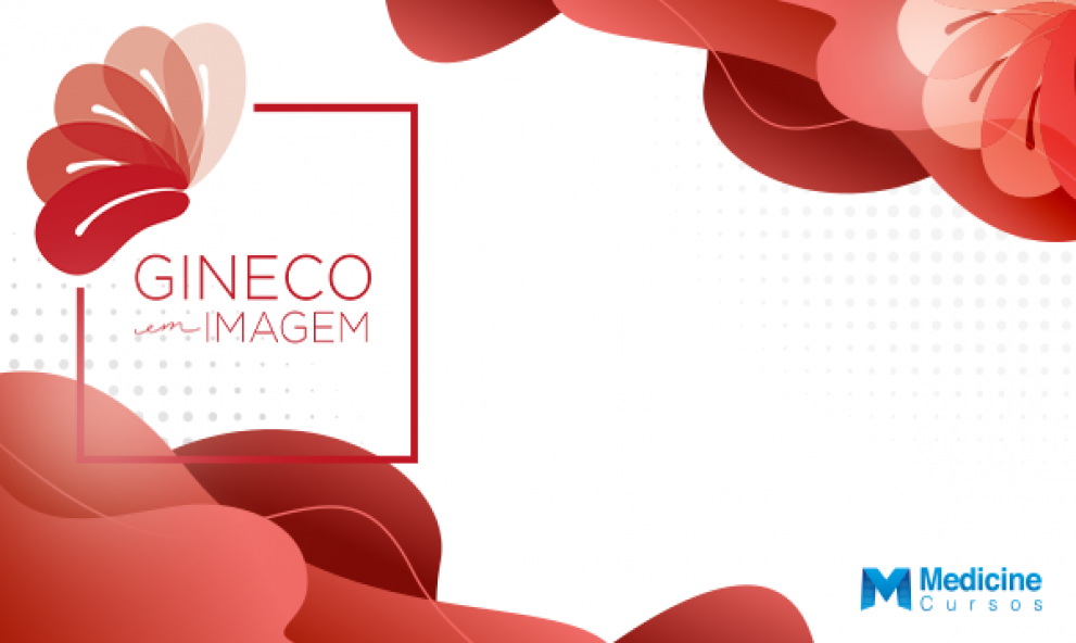 CURSO DE EXTENSÃO EM ULTRASSONOGRAFIA NA ENDOMETRIOSE GINECO EM IMAGEM