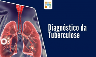 Diagnóstico laboratorial da tuberculose.