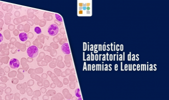 Diagnóstico laboratorial em anemias e leucemias.