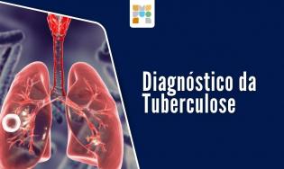 Diagnóstico laboratorial da tuberculose.