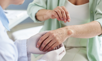 Prevenção e Tratamento de Lesões de Pele na Assistência à Saúde: Lesão por Pressão, DAÍ e Fricção
