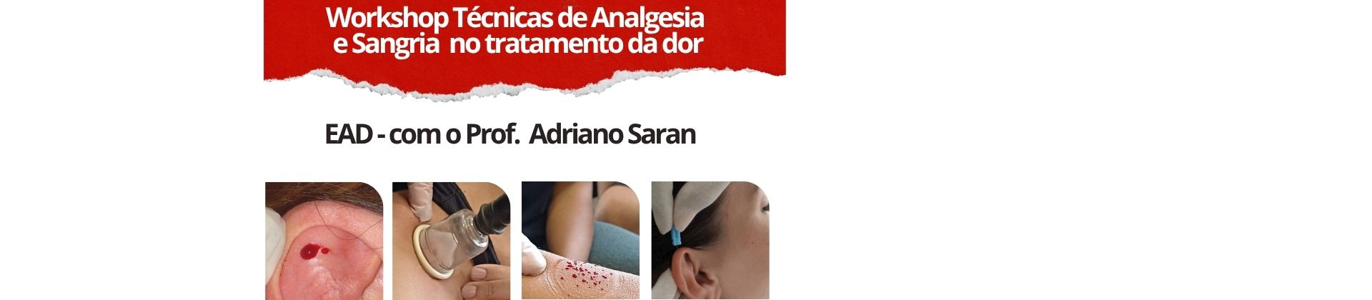 Workshop Técnicas de Analgesia e Sangria no tratamento da dor